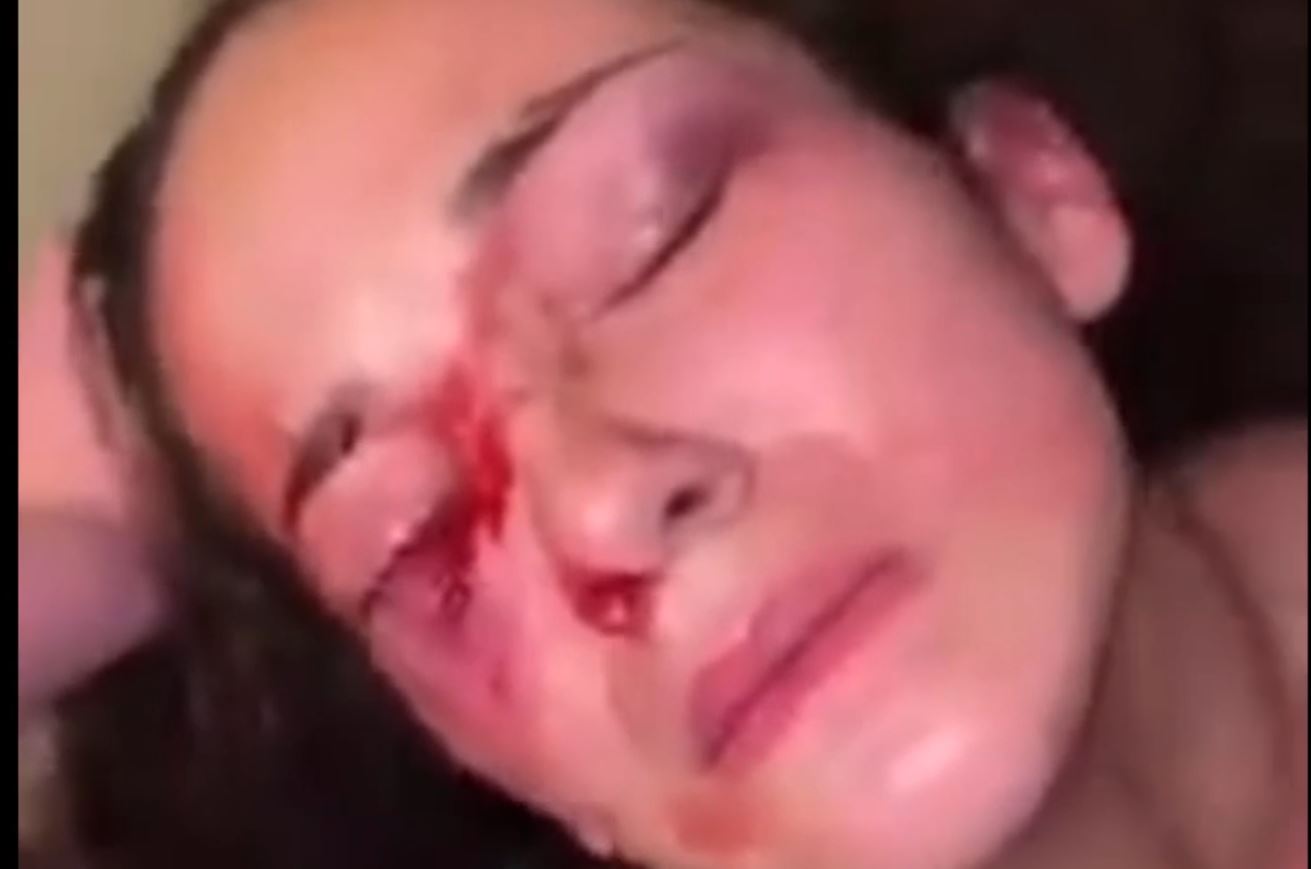 Bully girl beat up another girl